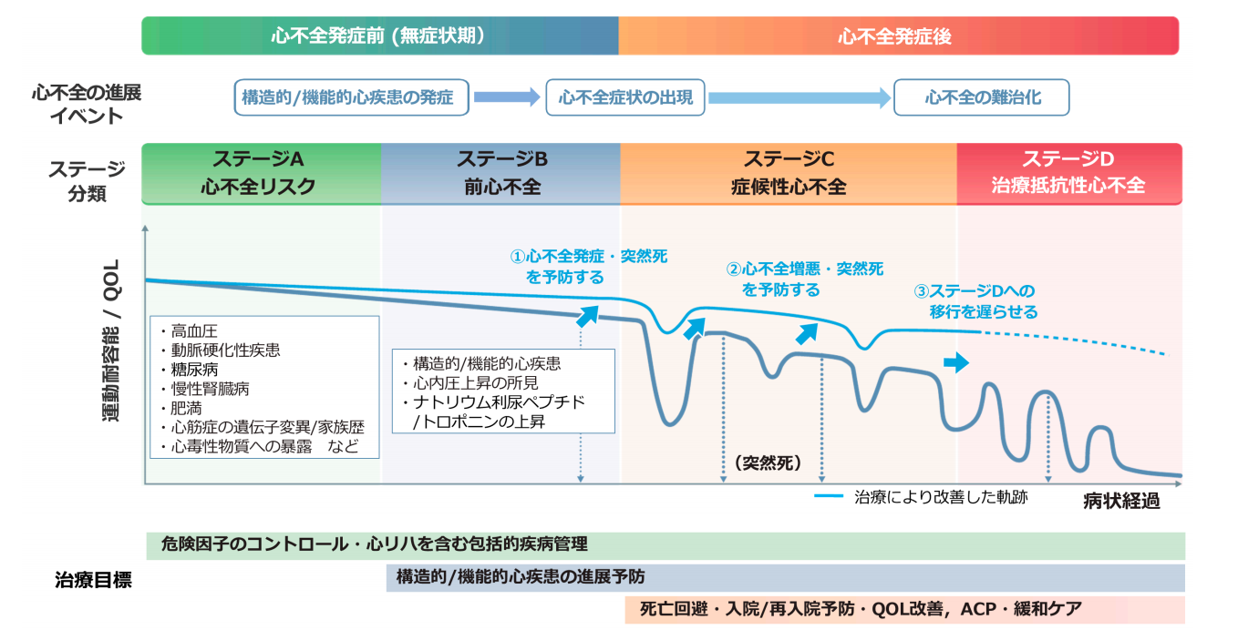 心不全の進展イベント