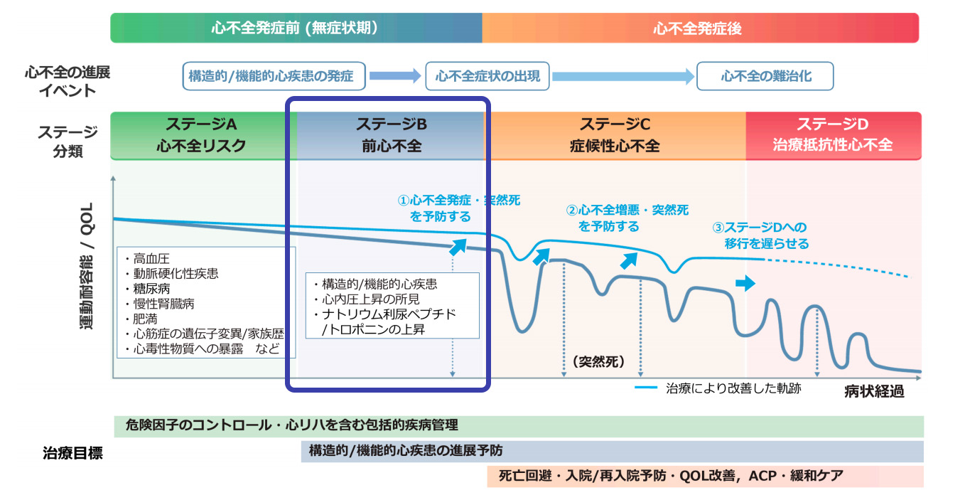 ステージB