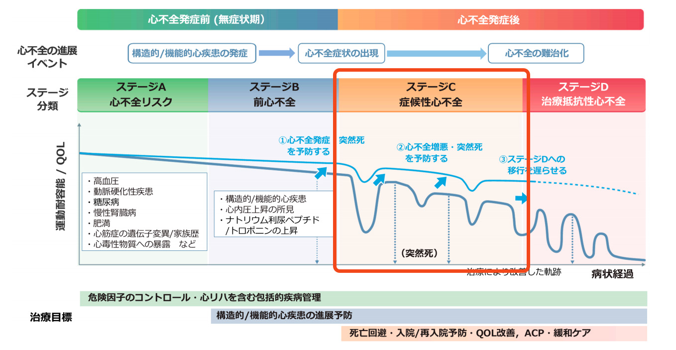 ステージC