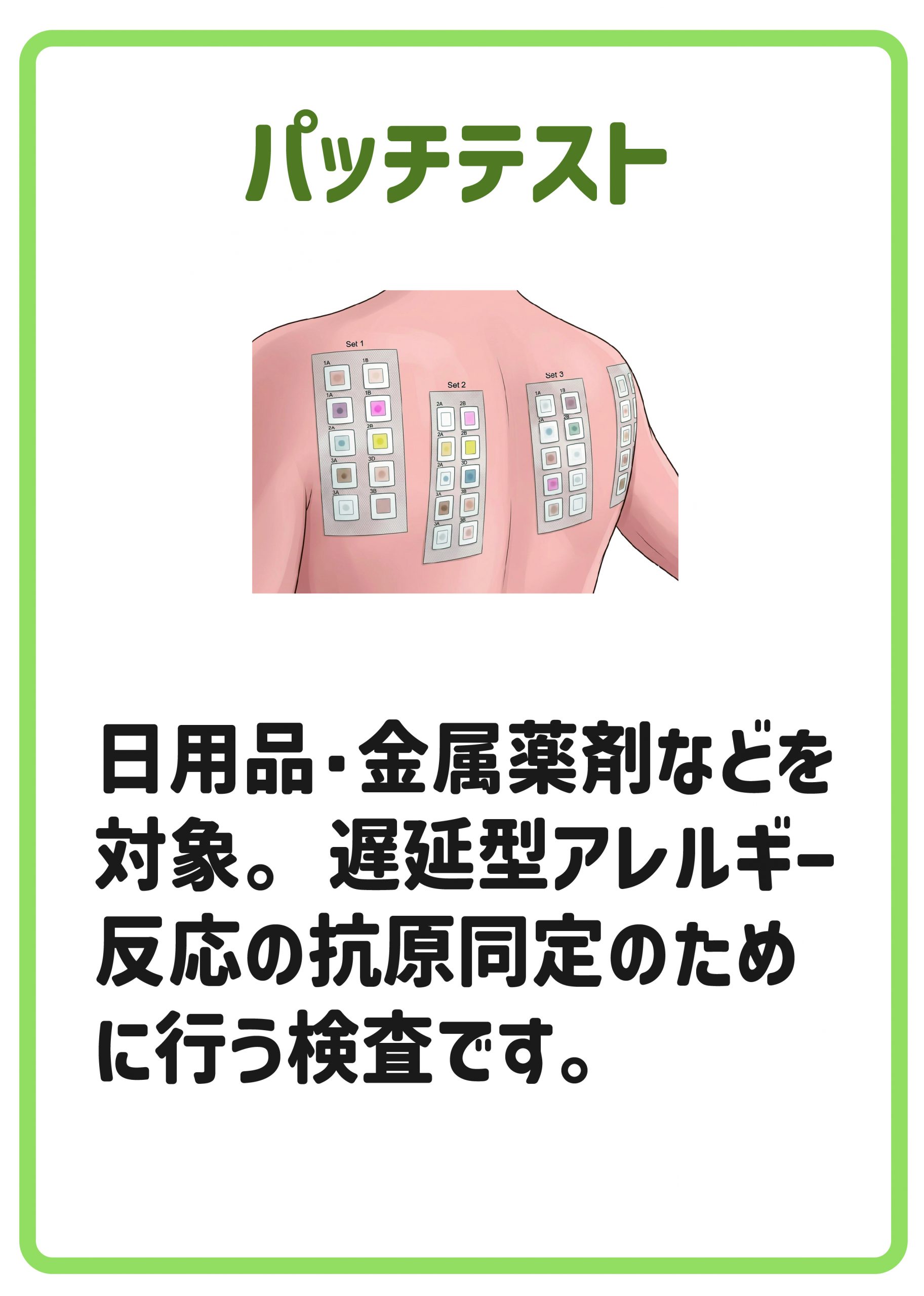 パッチテスト