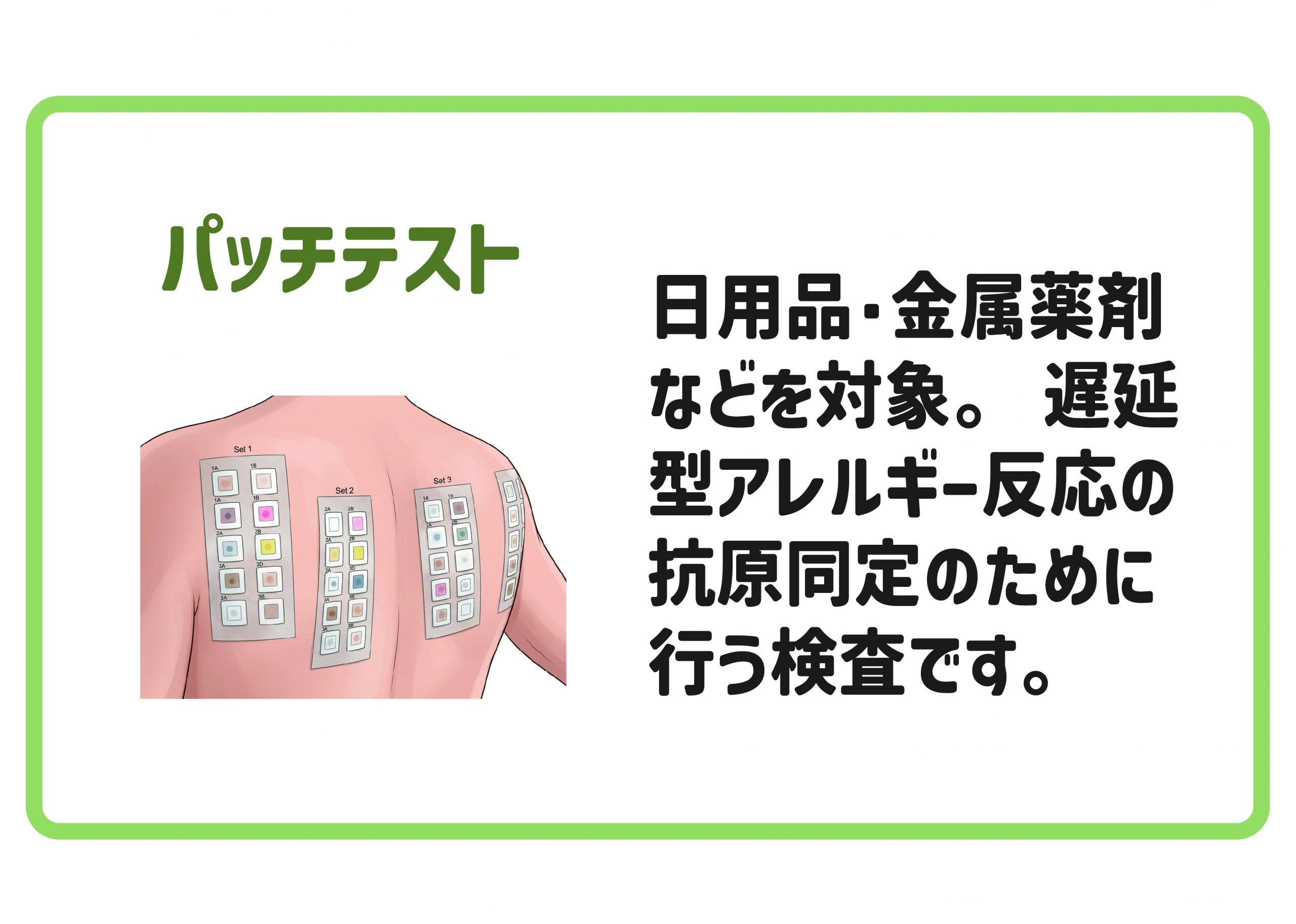 パッチテスト
